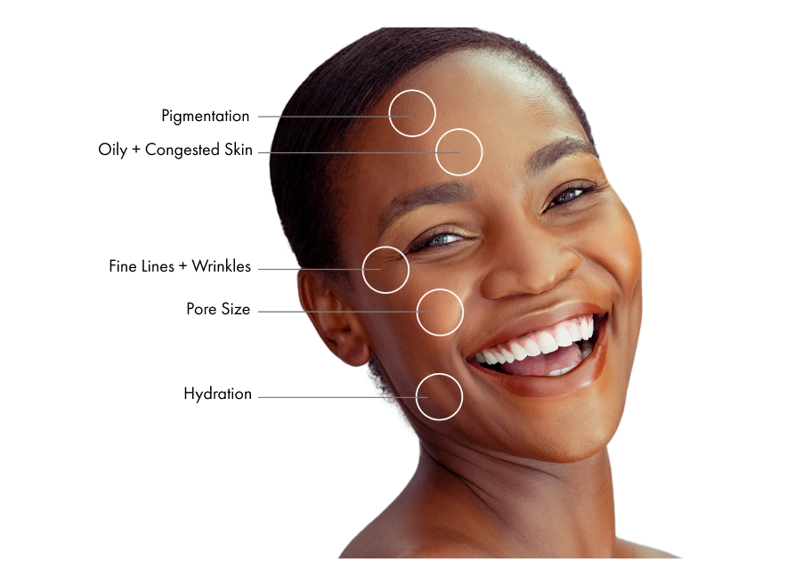 Woman has big and beautiful smile modeling the potential benefits that Hydrafacial treatment can provide in Westport, CT.