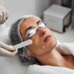 Provider performing a rosacea laser treatment on a patient's cheek