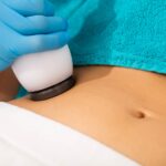 Provider performing a non-surgical fat reduction treatment on a patient's abdomen
